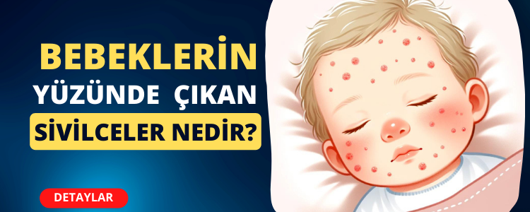 Bebeğin yüzünde çıkan kırmızı sivilce gibi benek nedir? Nasıl geçer?